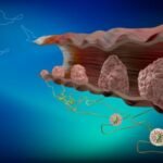 Anal HPV Taraması İstanbul