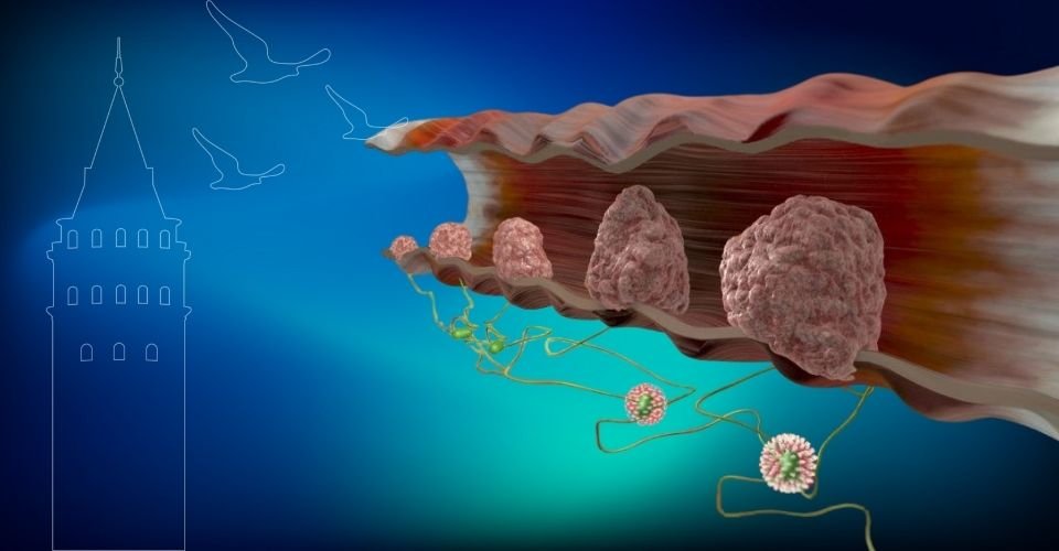 Anal HPV Taraması İstanbul