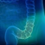 Kolorektal kanser belirtileri, tanı ve tedavi süreci hakkında merak ettiğiniz her şey. İstanbul'da kolorektal kanser tedavisi için 17 yıllık deneyime sahip Prof. Dr. Çiğdem Arslan’dan güvenilir destek alın.