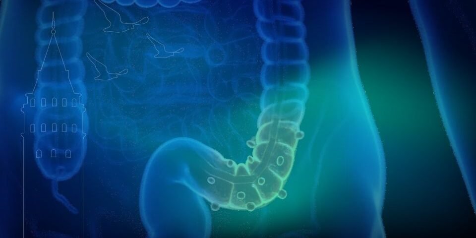 Kolorektal kanser belirtileri, tanı ve tedavi süreci hakkında merak ettiğiniz her şey. İstanbul'da kolorektal kanser tedavisi için 17 yıllık deneyime sahip Prof. Dr. Çiğdem Arslan’dan güvenilir destek alın.